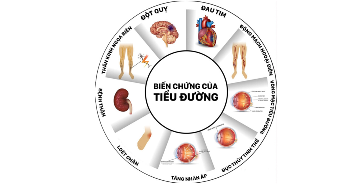 7 Triệu chứng bệnh Tiểu đường (đái tháo đường) và Chế độ ăn uống phù hợp