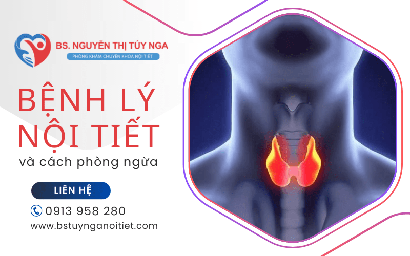 bệnh lý nội tiết