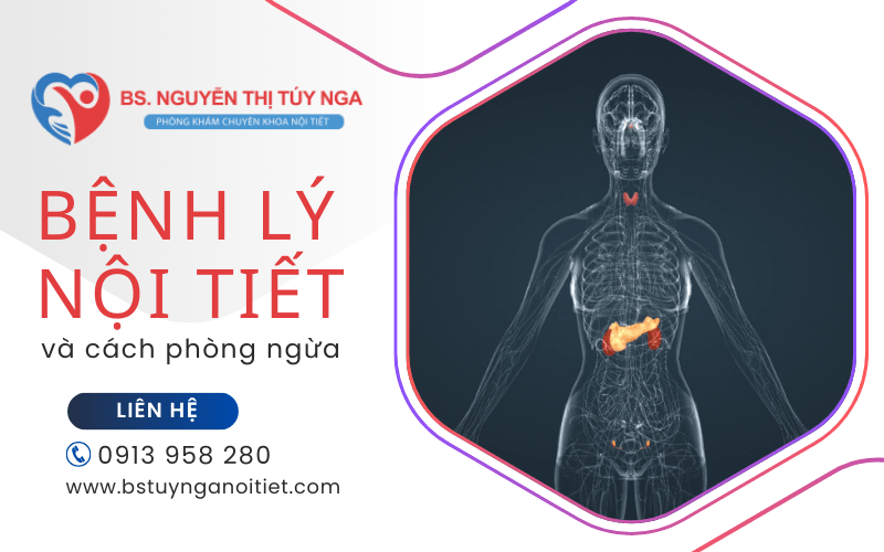 bệnh lý nội tiết