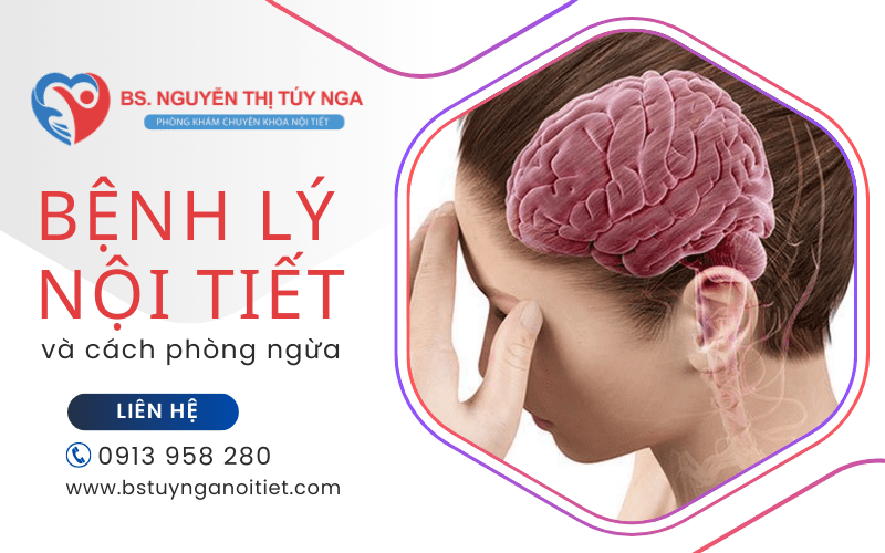 bệnh lý nội tiết