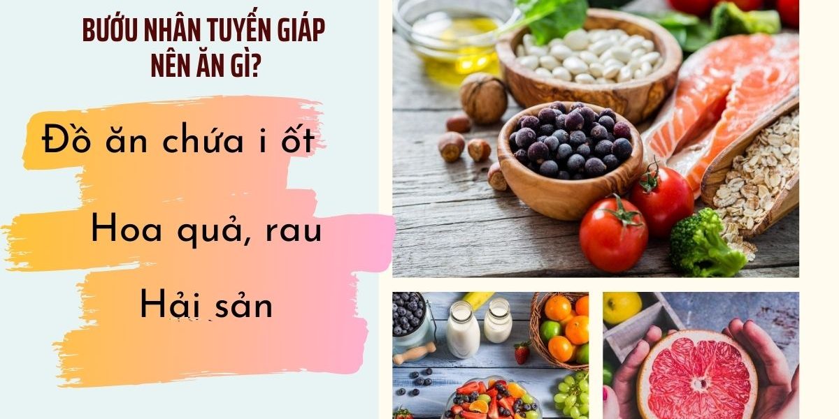 Bướu nhân tuyến giáp nên ăn gì