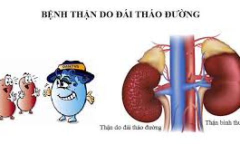 BIẾN CHỨNG THẬN DO BỆNH ĐÁI THÁO ĐƯỜNG