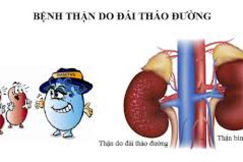 BIẾN CHỨNG THẬN DO BỆNH ĐÁI THÁO ĐƯỜNG